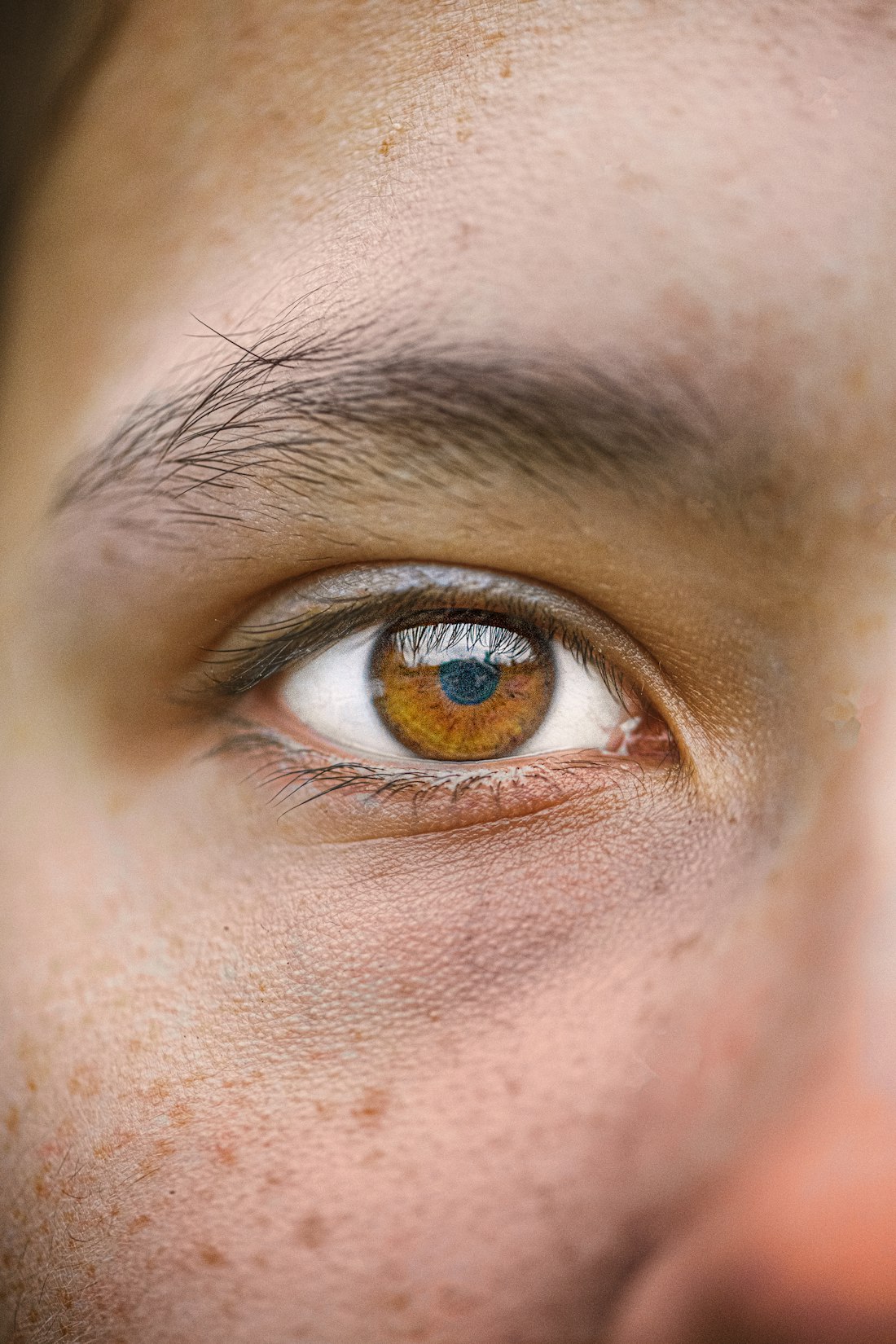 Amber lens on deep brown eyes (temporary comp)